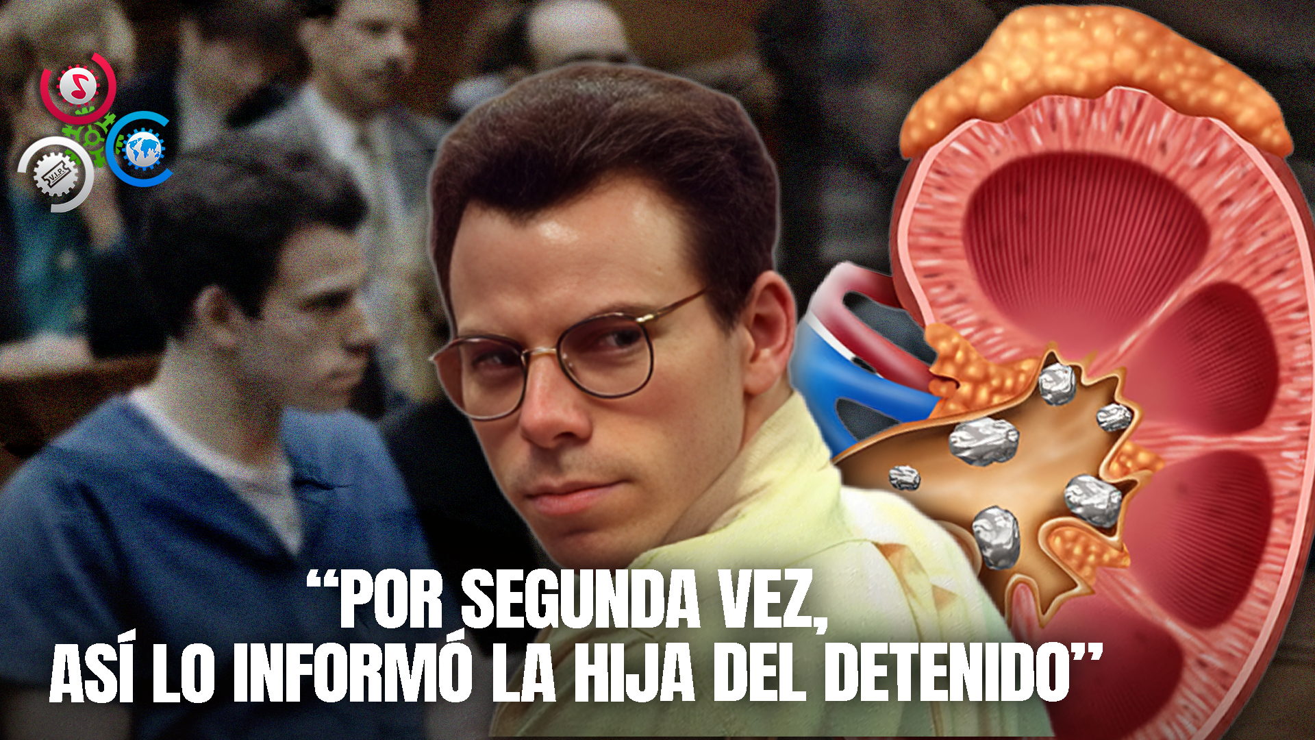 Erik Menéndez Se Somete A Cirugía Por Complicaciones Renales