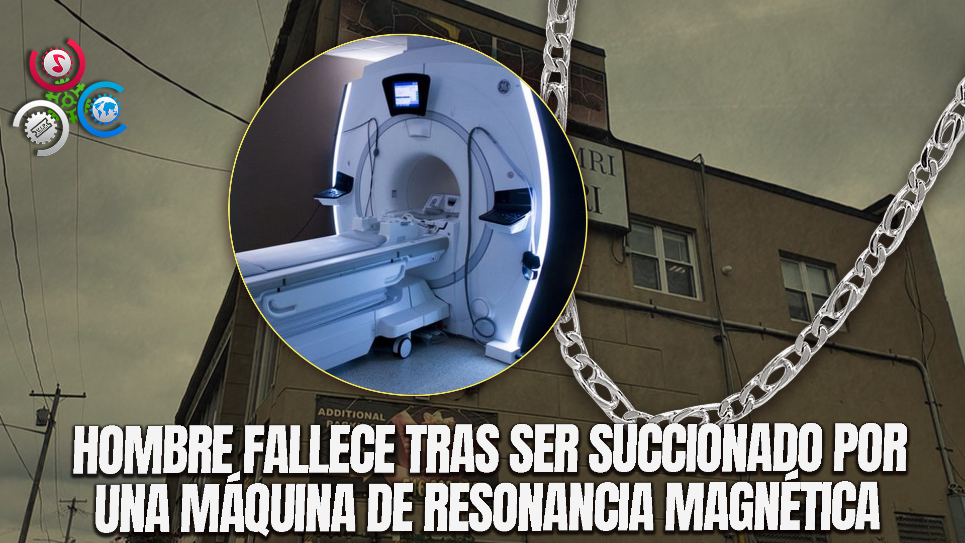 Hombre Muere Tras Ser ‘succionado’ Por Una Máquina De Resonancia Magnética En Clínica De NY