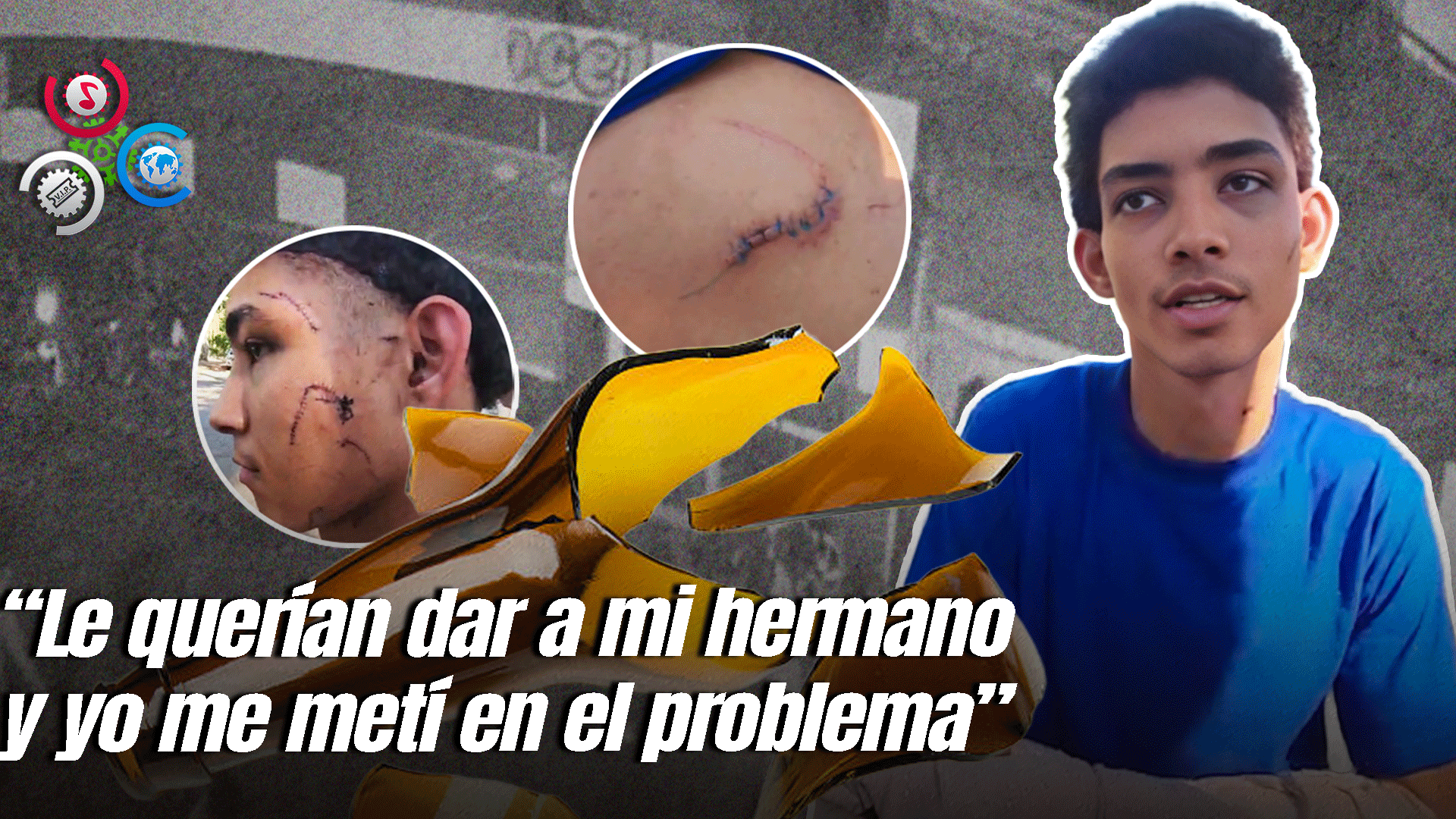 Joven Acude A La PN Y Denuncia Fue Agredido Con 17 Estocadas Por 4 Personas En Arroyo Hondo, Santiago