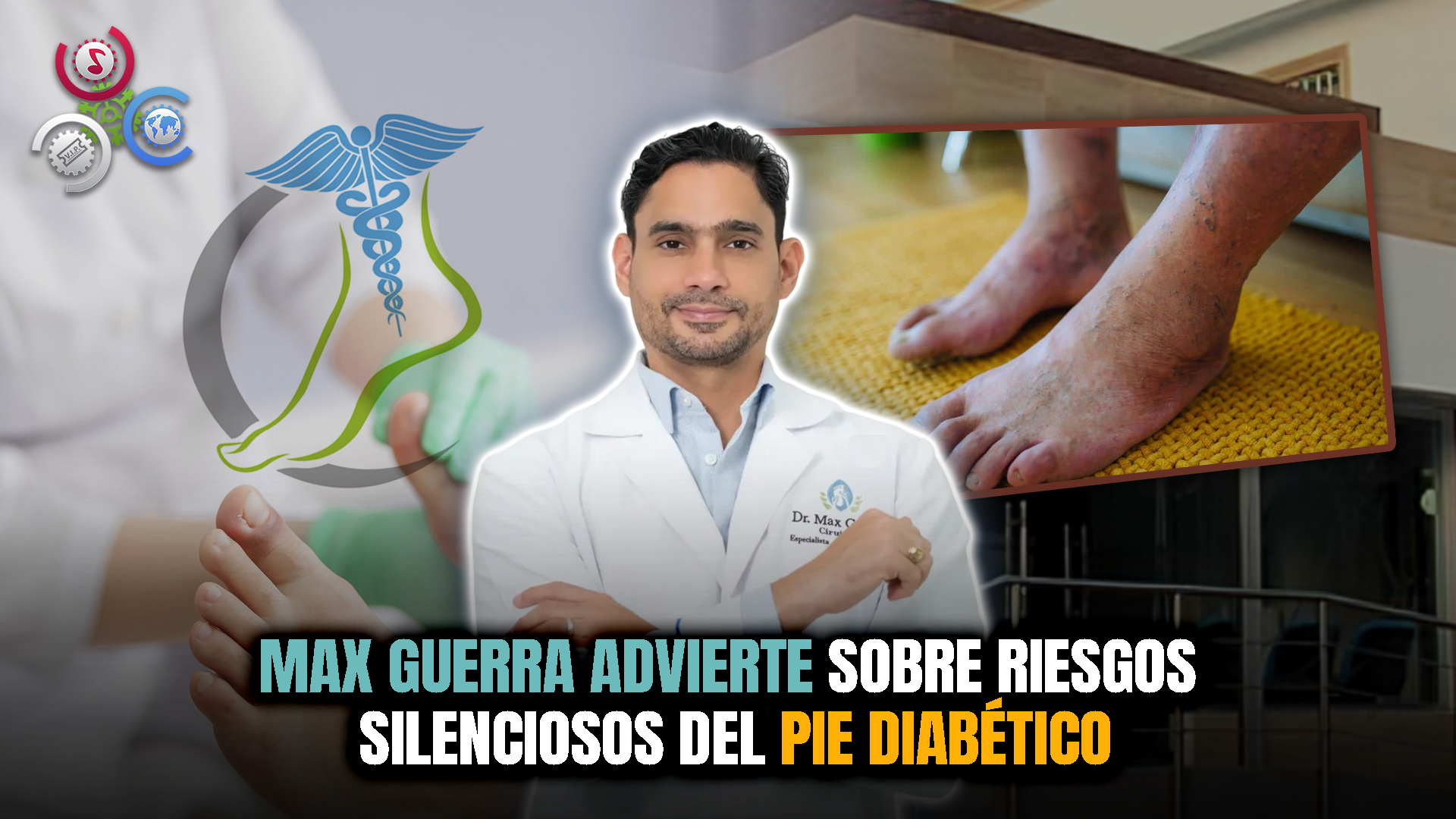 Max Guerra: “El Pie Diabético No Duele Y Precisamente Ese Es El Problema”