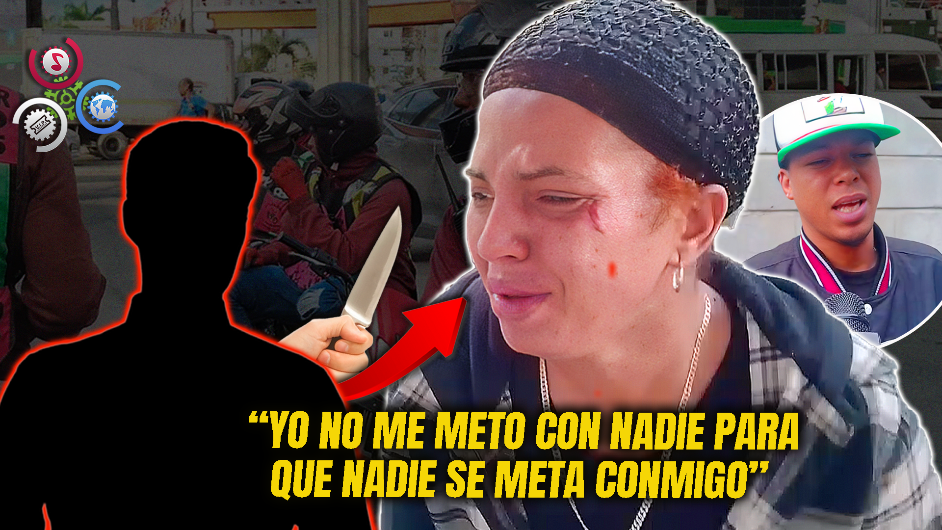 “Yo Fui A Defender Mi Marido Y él Me Dio”: Mujer Es Agredida En La Cara Por Motoconcho En Baracoa, Santiago